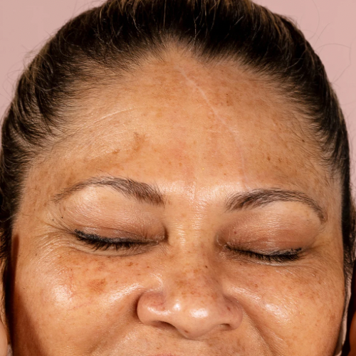 Aging Skin Care